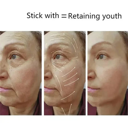 High Technology Intelligent Fractional RF Dot Matrix Beauty Machine For Skin Lift Wrinkle Removal Spa Cosmetic Device Skin Care