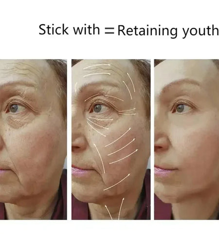 High Technology Intelligent Fractional RF Dot Matrix Beauty Machine For Skin Lift Wrinkle Removal Spa Cosmetic Device Skin Care