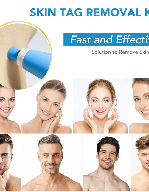 Load image into Gallery viewer, 2 IN 1 Auto Skin Tag Remover Kit Micro Skin Tag Removal Device Adult Mole Stain Wart Remover Face Care Beauty Tools Dropshipping
